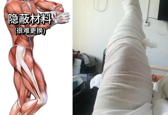 【血压飙升】有人把钱花刀刃上，装修公司都花刀背上！5万硬装人工和材料明细！隐蔽材料有啥坑？装修必看省钱攻略 | 装修流程02